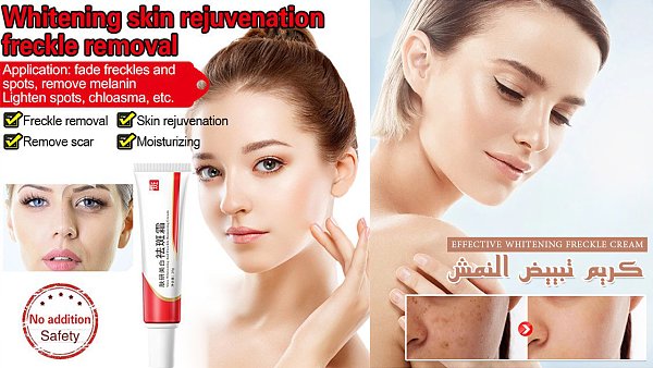 كريم تبييض النمش-✅ مكونات من الطبيعة. كريم تبييض النمش-✅ مكونات من الطبيعة.